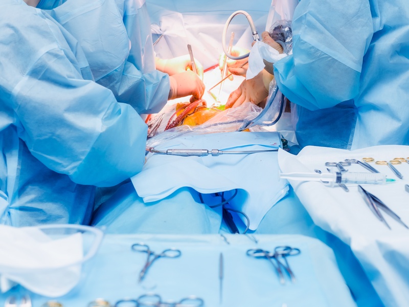 Chirurgie Laparoscopique oncologique et de la paroi abdominale
