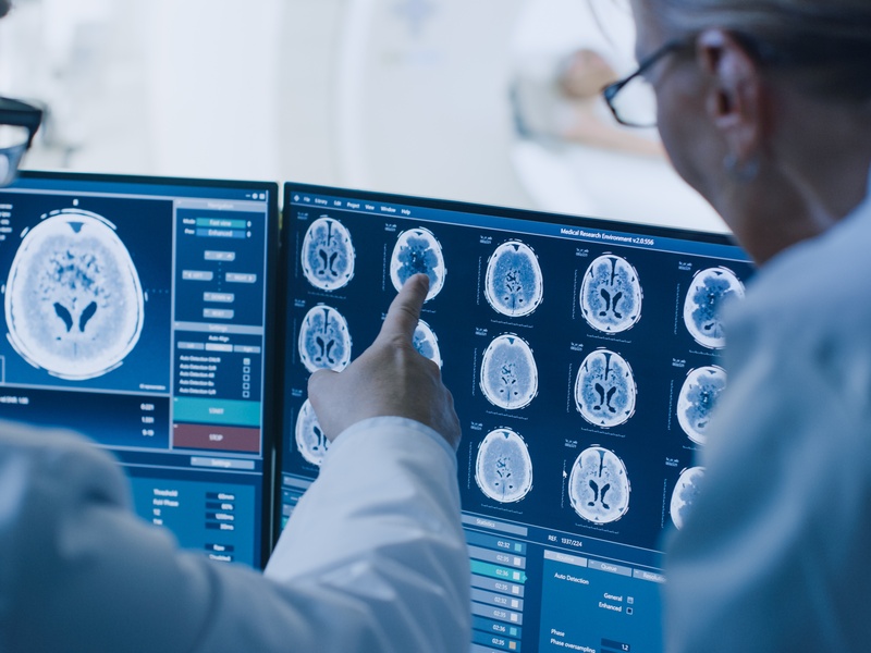 Neurochirurgie