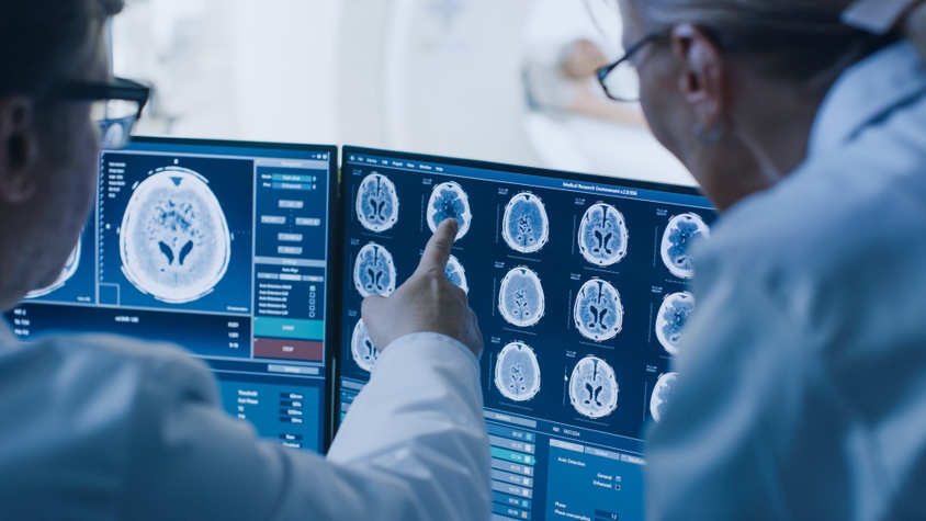 Neurochirurgie